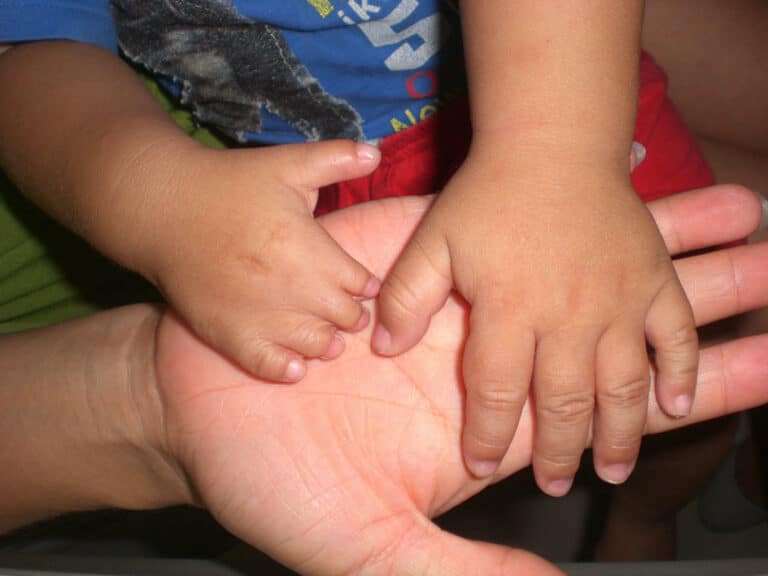 A Young Hand Surgery Patient